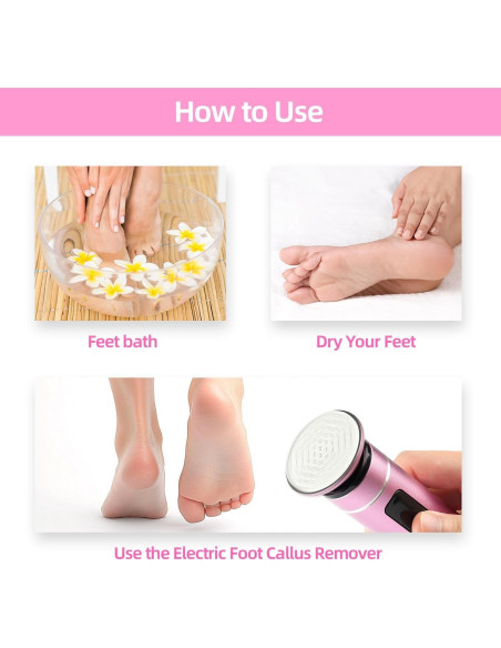 Removedor de Callos Eléctrico MARSDREAMS 802 Inalámbrico