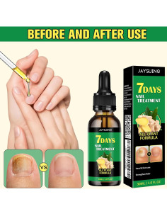 Suero de Crecimiento de Uñas de Jengibre Jewsuva 30 ml (2 Piezas) 2