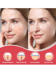 216 Parches Hidrocoloide AcneGo para Granitos y Manchas 2