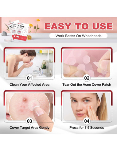 216 Parches Hidrocoloide AcneGo para Granitos y Manchas