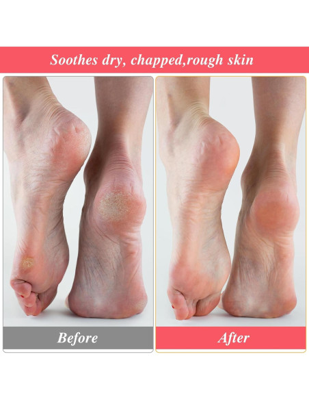 3 Pares Calcetines Hidratantes Algodón para Pies - Rosa