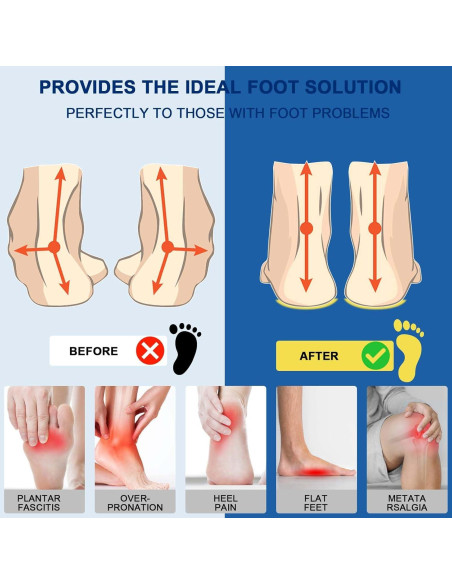 Plantillas de Soporte de Arco Alto Crinova para Fascitis Plantar Plantillas de Soporte de Arco Alto Crinova para Fascitis Plantar