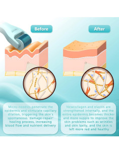 Kit Derma Roller 10 en 1 CIRNCR con 9 Cabezas Reemplazables 2