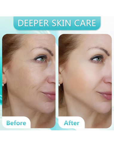 Kit Derma Roller 10 en 1 CIRNCR con 9 Cabezas Reemplazables