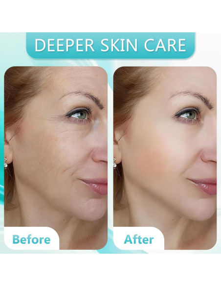 Kit Derma Roller 10 en 1 CIRNCR con 9 Cabezas Reemplazables Kit Derma Roller 10 en 1 CIRNCR con 9 Cabezas Reemplazables