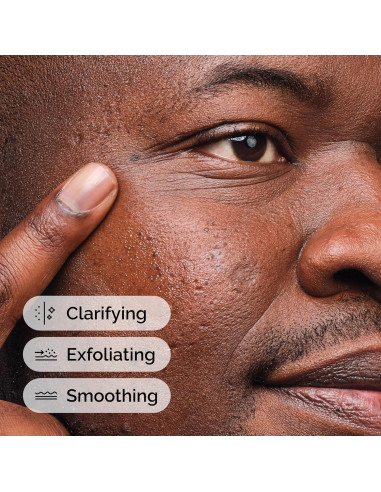 Suero Ácido Salicílico 2% The Ordinary 30 ml Piel Imperfecta