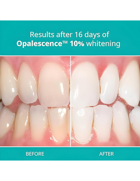 Gel Blanqueador Dental Opalescence 10% - 4 Jeringas 1.2ml