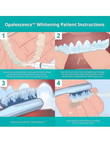 Gel Blanqueador Dental Opalescence 10% - 4 Jeringas 1.2ml