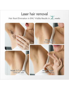 Dispositivo de Eliminación de Vello Láser IPL Aristorm Verde 2