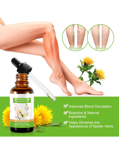 Aceite Esencial IKZEE para Venas Varicosas 30ML - Hidratante