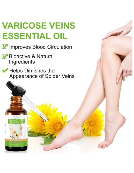 Aceite Esencial IKZEE para Venas Varicosas 30ML - Hidratante
