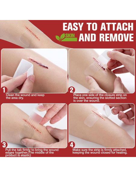 Kit de Cierre de Heridas Dotodo 4PCS - Vendajes Mariposa