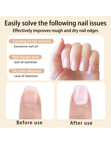 Bolígrafo de Aceite para Cutículas 12 Piezas Cuidado Uñas