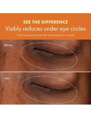 Crema para Ojos Origins GinZing 36g - Iluminadora y Anti-Ojeras