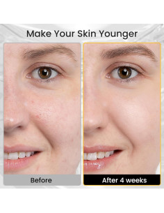 Máscara de Luz LED Iarha 8 Colores Terapia Facial 240 Perlas 2