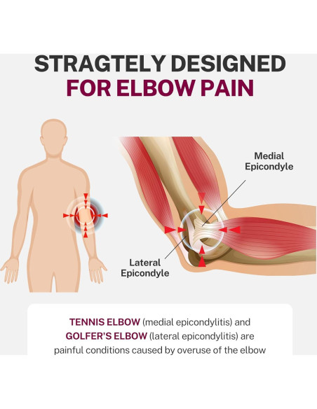 Manga de Compresión para Codo Fitomo SEP4 - Tamaño S