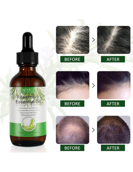 Aceite Esencial de Romero 59.87 ml - Crecimiento Cabello y Piel