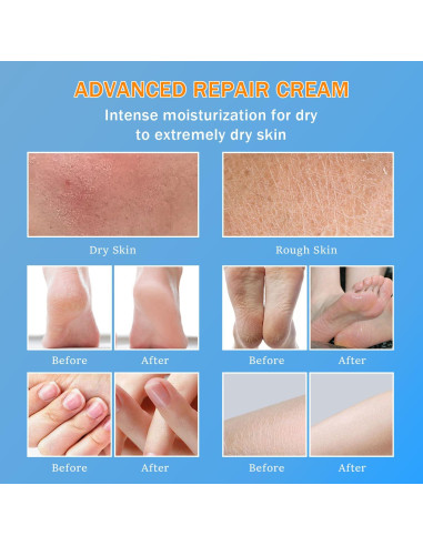 Crema de Urea 60% YOUNGYOUNGLOVE 150ml Hidratante para Pies