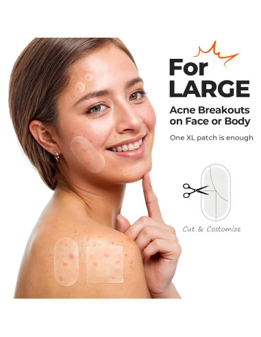 Parche Hidrocoloide XL TKTK para Acné - 124 Parches 60x30mm