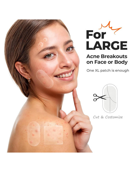Parche Hidrocoloide XL TKTK para Acné - 124 Parches 60x30mm Parche Hidrocoloide XL TKTK para Acné - 124 Parches 60x30mm