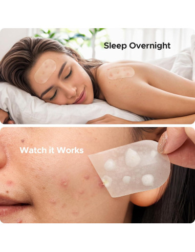 Parche Hidrocoloide XL TKTK para Acné - 124 Parches 60x30mm