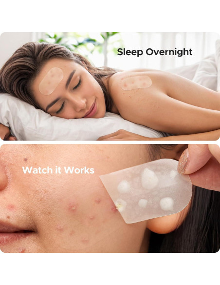 Parche Hidrocoloide XL TKTK para Acné - 124 Parches 60x30mm Parche Hidrocoloide XL TKTK para Acné - 124 Parches 60x30mm