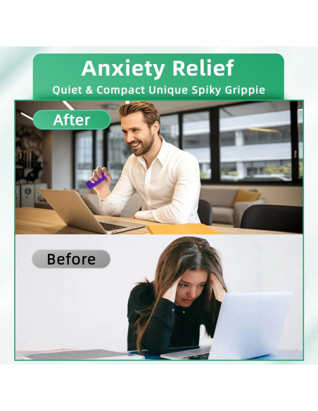 Paquete de 2 Juguetes Fidget Little Ouchies ALDWDY - Alivio Estrés