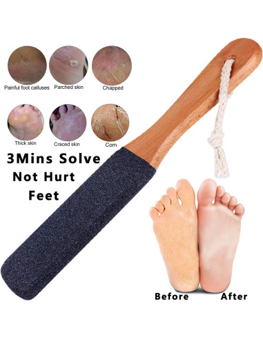 Lima para Pies Kinepi - Removedor de Callos y Durezas 25cm