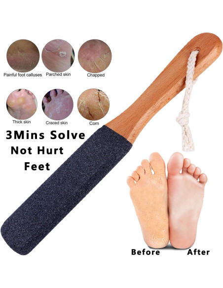 Lima para Pies Kinepi - Removedor de Callos y Durezas 25cm Lima para Pies Kinepi - Removedor de Callos y Durezas 25cm