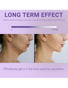 Correa para Barbilla para Dormir Sfuchin - Reductor Doble Barbilla 2