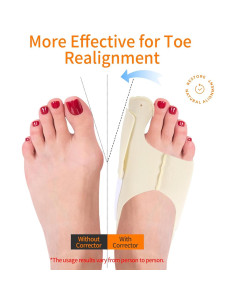 Corrector de Hallux Valgus NOWFRESH 2 Piezas Ajustable - Alivio para Juanetes 2