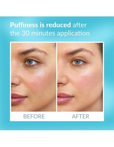 Parche Ocular Talika - Terapia Suavizante Reutilizable 1 Unidad