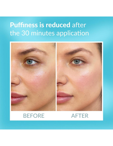 Parche Ocular Talika - Terapia Suavizante Reutilizable 1 Unidad