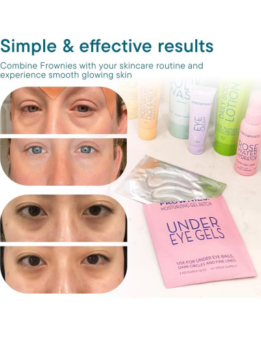 Parche de Gel Frownies para Ojos - Reutilizable, 3 Piezas