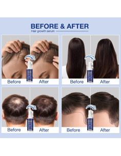 Spray Crecimiento Cabello VENANOCI 59 ml - Romero y Biotina 2