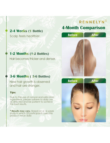 Spray Crecimiento Cabello Rennelyn 60ml Aceite Romero Ricino