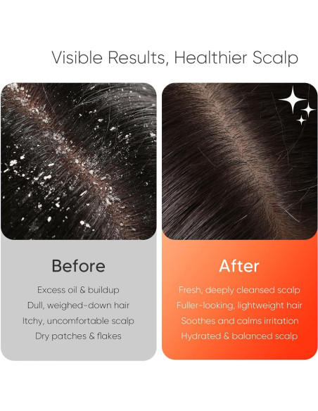 Cepillo de Masaje Eléctrico EKZ para Cuero Cabelludo - Silicona