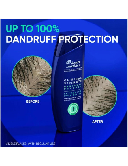 Champú 2-en-1 Head & Shoulders Clinical Strength 400 mL x2 - Alivio Caspa Champú 2-en-1 Head & Shoulders Clinical Strength 400 mL x2 - Alivio Caspa