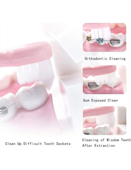 4 Cepillos de Dientes Ortodónticos Wisdom Tuft Cabeza Pequeña