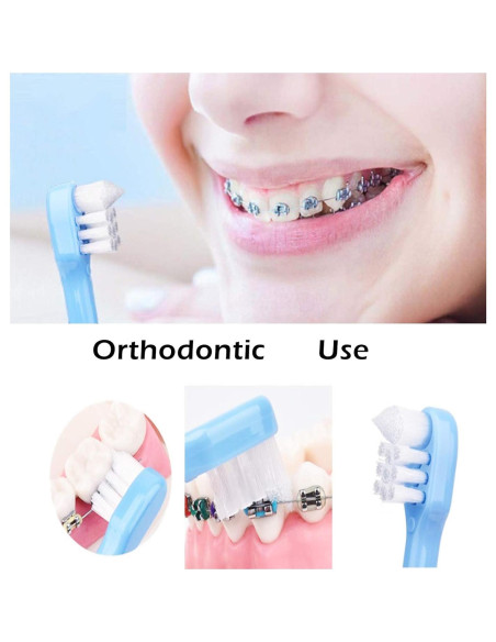 4 Cepillos de Dientes Ortodónticos Wisdom Tuft Cabeza Pequeña