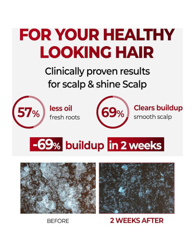 Champú KUNDAL para Cuero Cabelludo con Cafeína 500 ml