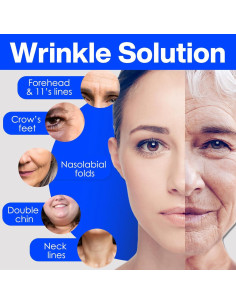 Cinta Facial Antiarrugas Zancony 2.5CM Beige - Elevación Facial 2