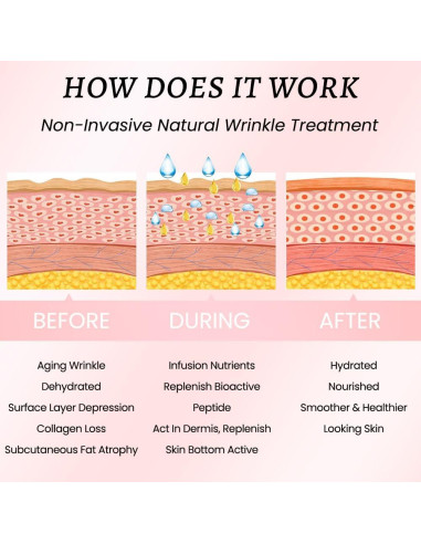 Parches Antiarrugas Kaely 192 Pcs Silicona para la Cara