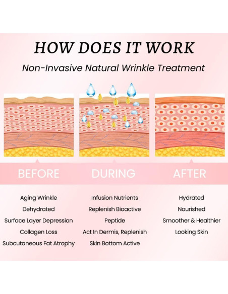 Parches Antiarrugas Kaely 192 Pcs Silicona para la Cara