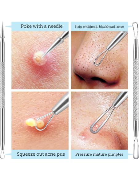 Kit de Herramientas para Remover Puntos Negros LitBear - Acero Inoxidable