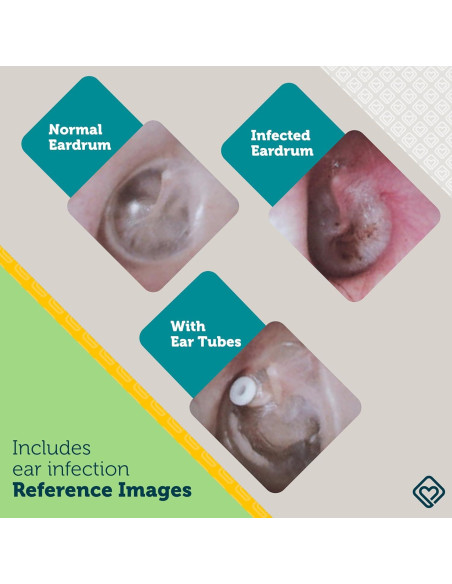 Otoscopio de oído Safety 1st IH481 con luz LED