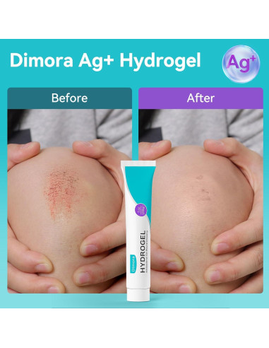 Gel Antibacteriano Dimora Hidrogel Plata 28.35g para Heridas