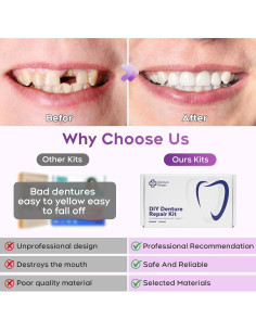 Kit de Dentaduras DIY AYROX - Dientes Falsos Personalizados 2