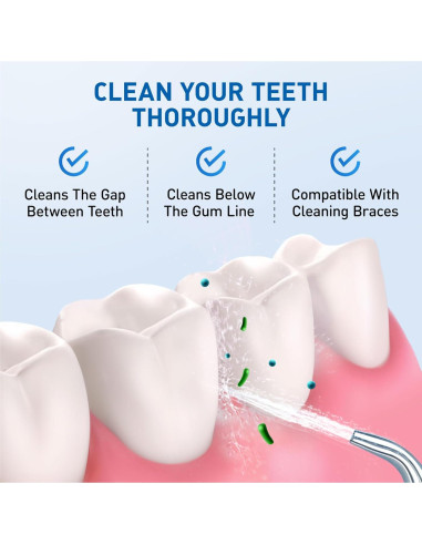 Cabezas de Reemplazo para Flosser de Agua Waterpik - 6 Consejos Clásicos