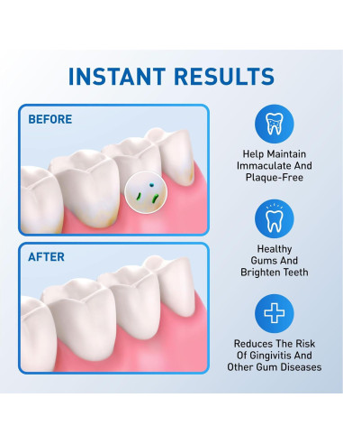 Cabezas de Reemplazo para Flosser de Agua Waterpik - 6 Consejos Clásicos